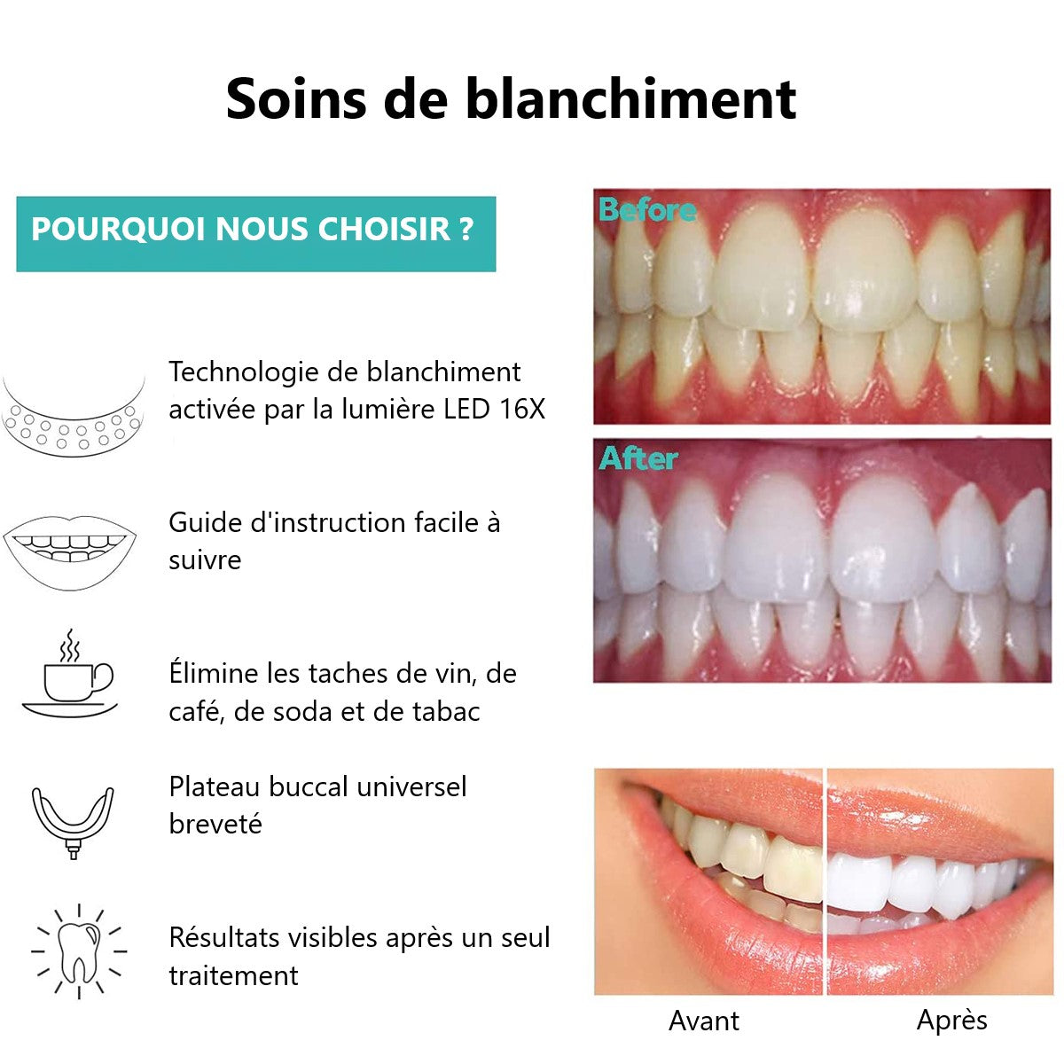 Appareil Led Pour Blanchiment Dentaire - Transparent